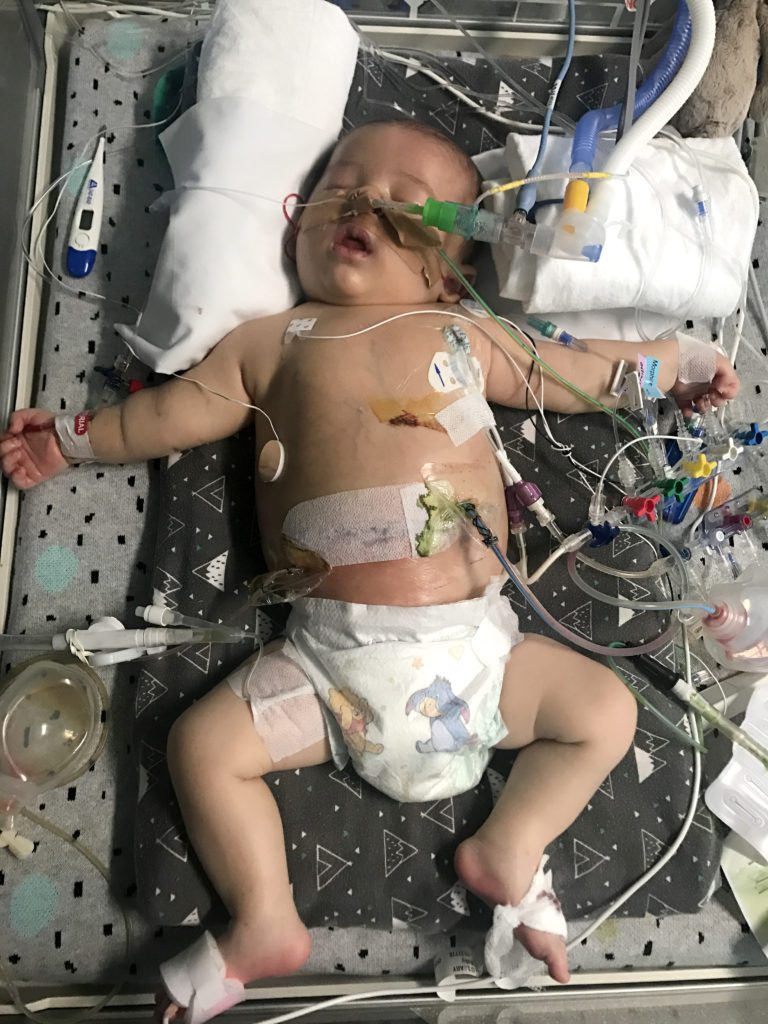 Baby Quinn lying in a crib with lots of tubes and wires connected to him